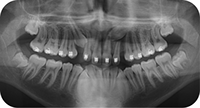 Middleton Orthodontics, Ortho & Surgery, TADS